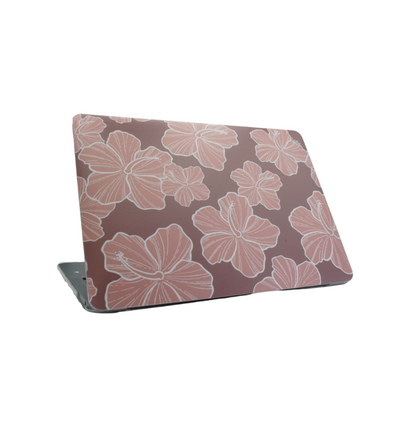 Hibiscus Dream - Macbook Hardshell